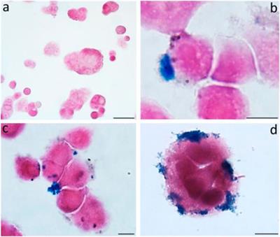 Therapeutic Applications of Magnetotactic Bacteria and Magnetosomes: A Review Emphasizing on the Cancer Treatment